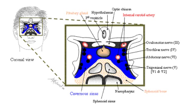 Observe the relationship of the nose, the sphenoid bone, sphenoidal sinus and the pituitary gland in the illustration
